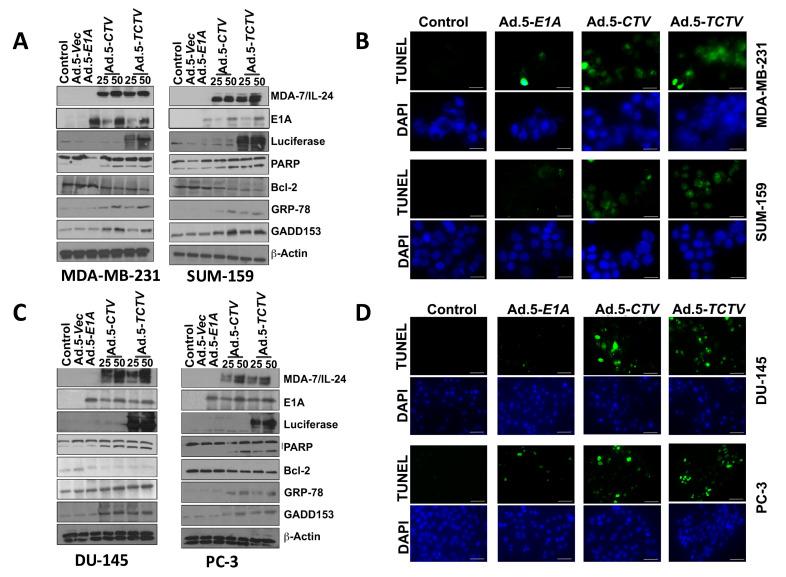 https://cdn.ncbi.nlm.nih.gov/pmc/blobs/9c36/7922065/35c54051de26/cancers-13-00857-g003.jpg