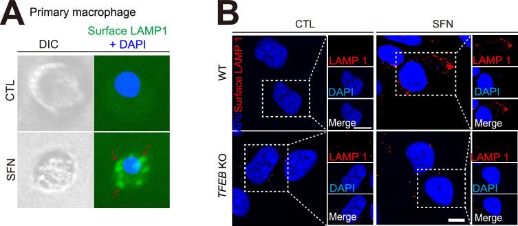 https://cdn.ncbi.nlm.nih.gov/pmc/blobs/9d3c/11970905/4e48edbdfa8e/elife-103137-fig4-figsupp1.jpg
