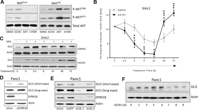 https://cdn.ncbi.nlm.nih.gov/pmc/blobs/9f25/5352201/ee67df4b3581/oncotarget-08-833-g005.jpg