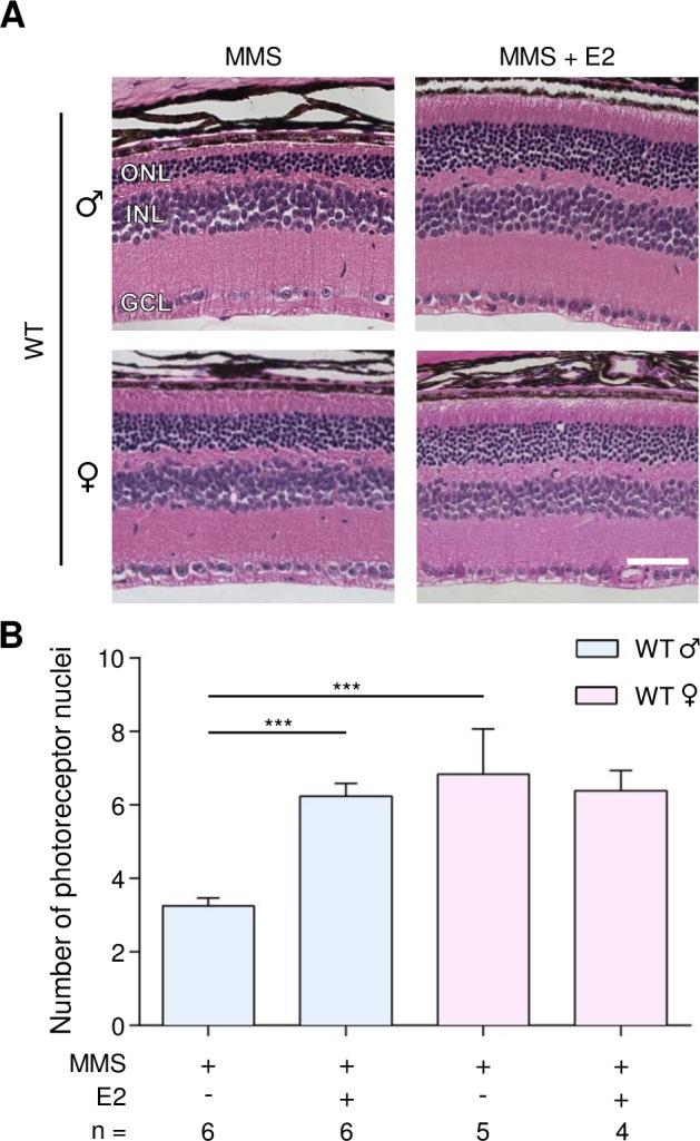 https://cdn.ncbi.nlm.nih.gov/pmc/blobs/a4d8/5620290/7e7bd3f3d2aa/oncotarget-08-68707-g003.jpg