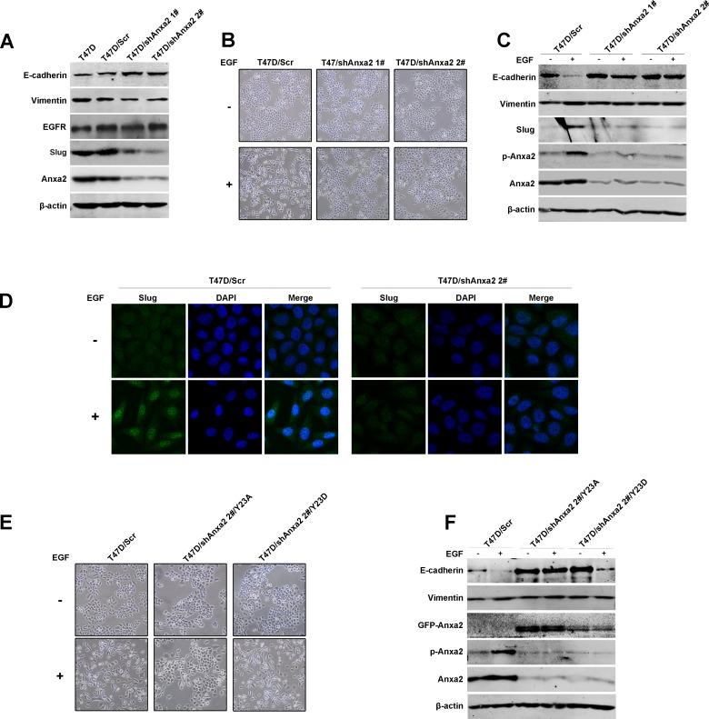 https://cdn.ncbi.nlm.nih.gov/pmc/blobs/a52b/4741582/6c022988bee1/oncotarget-06-30975-g002.jpg
