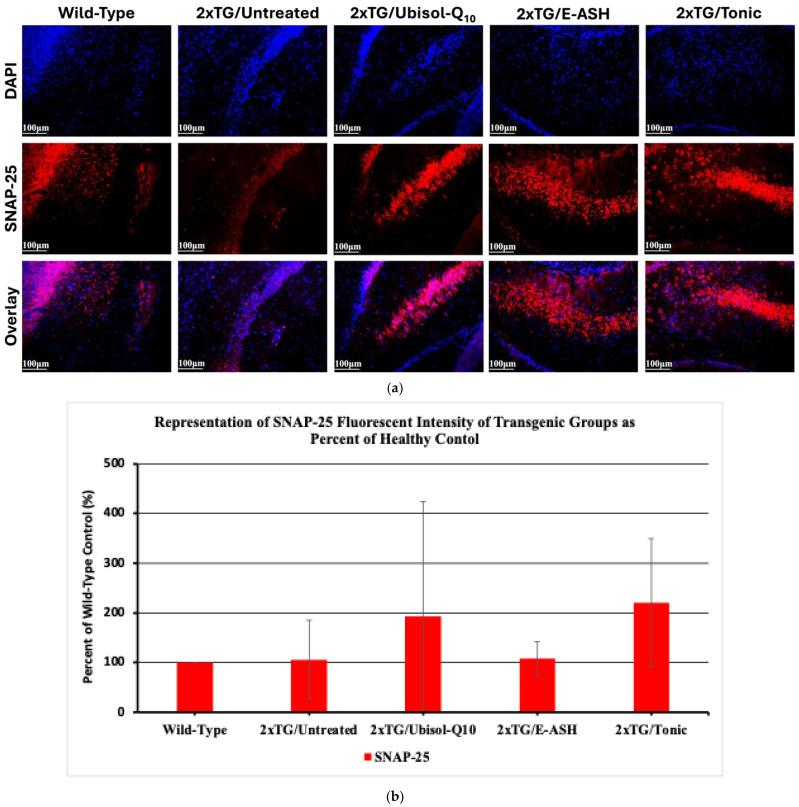 https://cdn.ncbi.nlm.nih.gov/pmc/blobs/a629/12389564/436fd0c7e4d8/nutrients-17-02701-g010.jpg