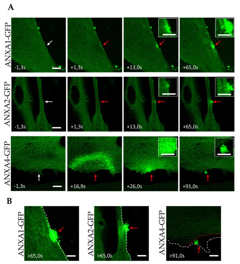 https://cdn.ncbi.nlm.nih.gov/pmc/blobs/a6e0/8877144/59edc12c32cf/membranes-12-00153-g002.jpg