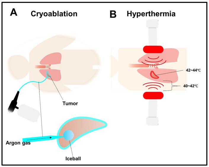 https://cdn.ncbi.nlm.nih.gov/pmc/blobs/a718/10930724/2ce3b7edfaa5/cells-13-00436-g003.jpg