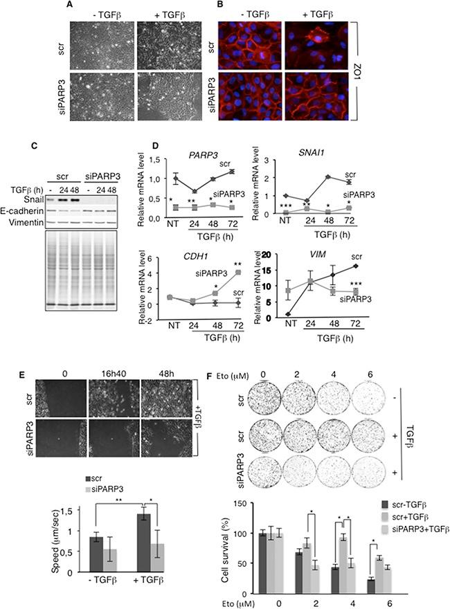 https://cdn.ncbi.nlm.nih.gov/pmc/blobs/a916/5325429/c38d179e5801/oncotarget-07-64109-g003.jpg