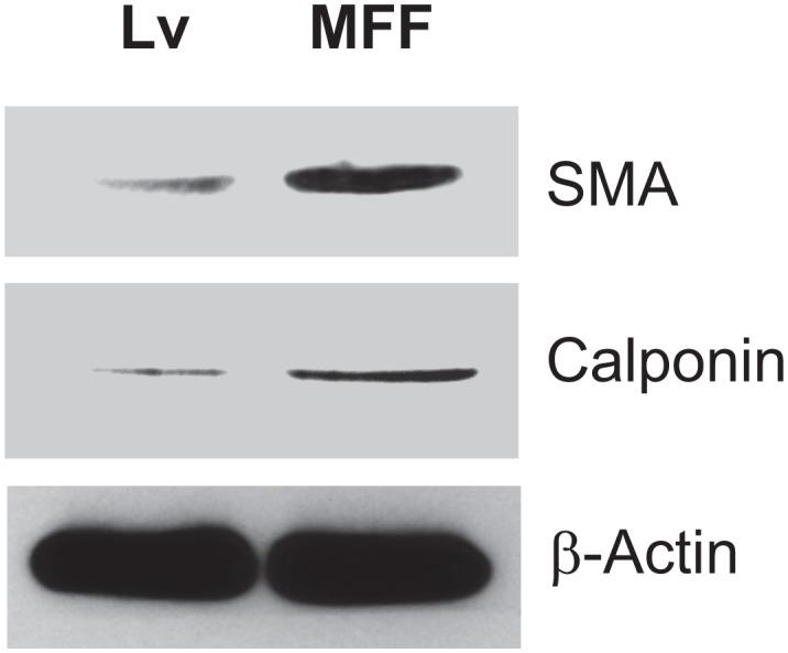https://cdn.ncbi.nlm.nih.gov/pmc/blobs/ac09/3478457/91376b505ec1/oncotarget-08-798-g006.jpg