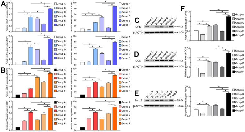 https://cdn.ncbi.nlm.nih.gov/pmc/blobs/ae75/8660623/23c1fddd1966/aging-13-203718-g003.jpg