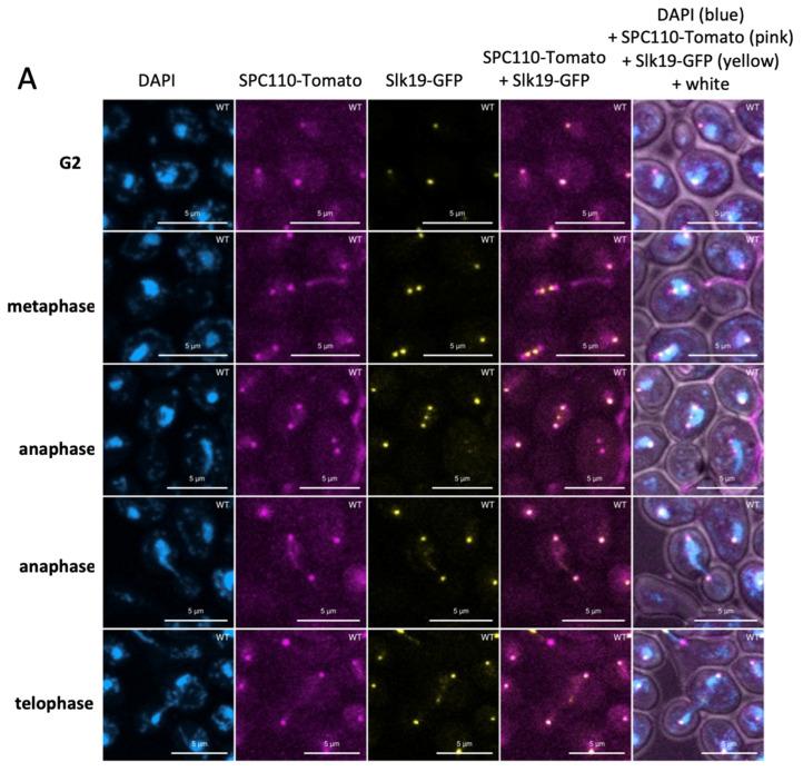 https://cdn.ncbi.nlm.nih.gov/pmc/blobs/af43/12153855/b0af147c20e9/cells-14-00784-g006a.jpg