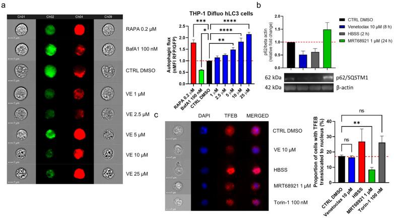 https://cdn.ncbi.nlm.nih.gov/pmc/blobs/afe0/8466897/d072e30a5b9c/cancers-13-04557-g006.jpg