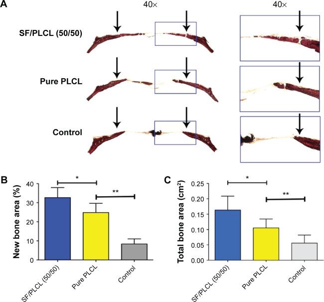https://cdn.ncbi.nlm.nih.gov/pmc/blobs/b0f4/4833379/abd475b497f4/ijn-11-1483Fig7.jpg