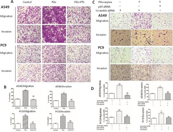 https://cdn.ncbi.nlm.nih.gov/pmc/blobs/b447/4745730/83b4a9be5d18/oncotarget-06-29335-g006.jpg