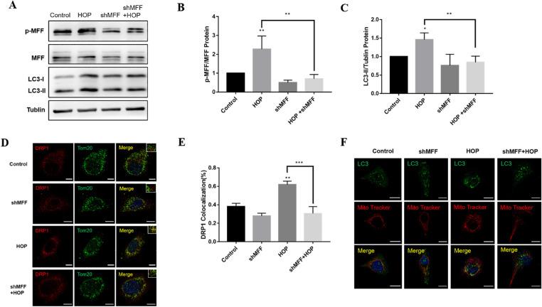 https://cdn.ncbi.nlm.nih.gov/pmc/blobs/b46a/9669805/ea90ece7cfd8/iovs-63-12-18-f006.jpg