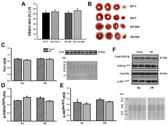 https://cdn.ncbi.nlm.nih.gov/pmc/blobs/b891/4914256/973ccfb739db/oncotarget-07-11889-g005.jpg