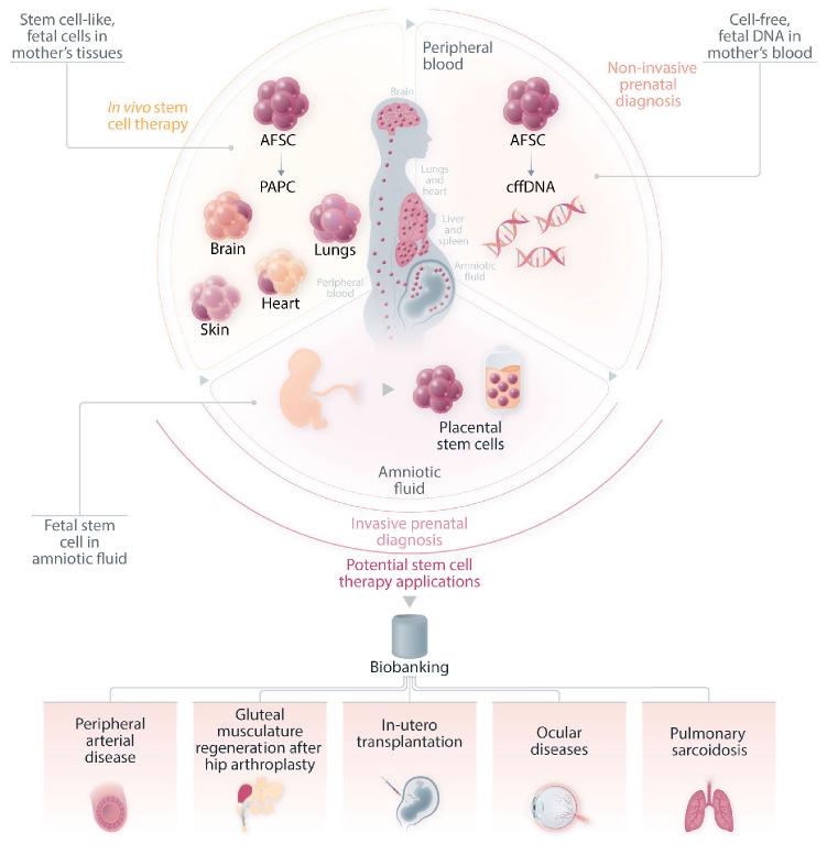 https://cdn.ncbi.nlm.nih.gov/pmc/blobs/b8b5/10316241/f216e482f3c3/1081731.fig1.jpg