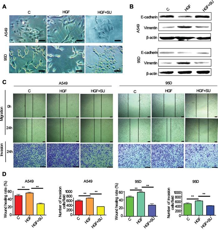 https://cdn.ncbi.nlm.nih.gov/pmc/blobs/b9f3/4951285/58268714fffd/oncotarget-07-18247-g002.jpg
