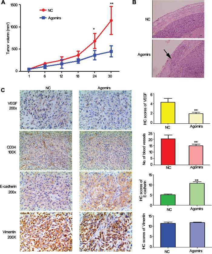 https://cdn.ncbi.nlm.nih.gov/pmc/blobs/b9f3/4951285/db4fafe36141/oncotarget-07-18247-g008.jpg