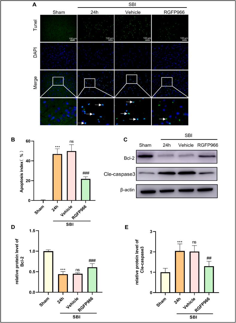 https://cdn.ncbi.nlm.nih.gov/pmc/blobs/bfdd/10395478/715aca6ad44c/gr3.jpg