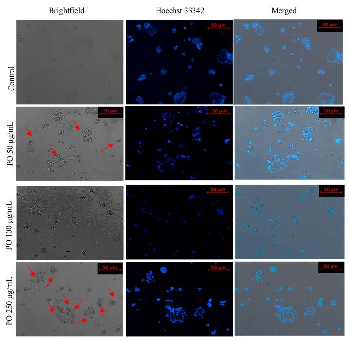 https://cdn.ncbi.nlm.nih.gov/pmc/blobs/c4fa/9502197/9c18f8dcf0dd/metabolites-12-00821-g007.jpg
