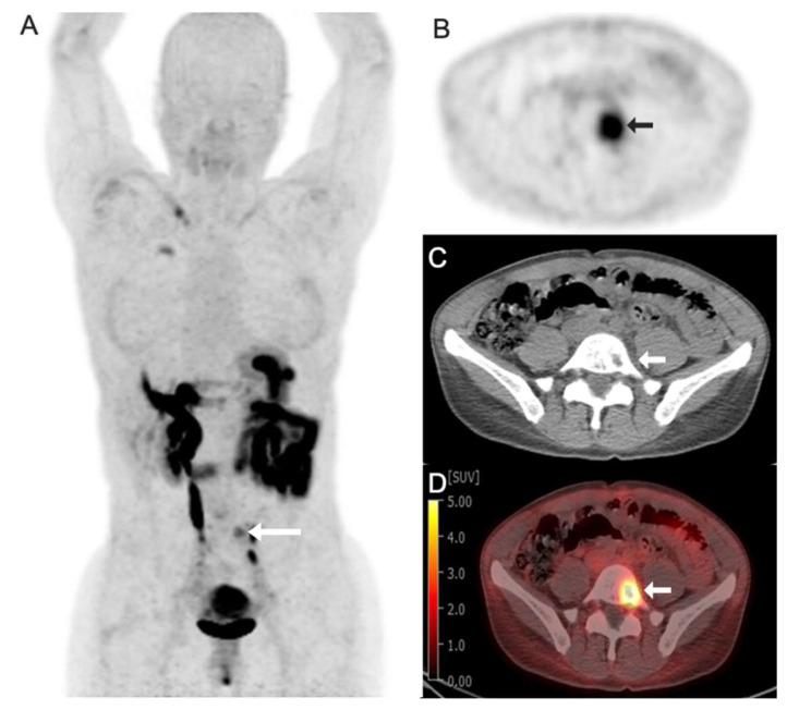 https://cdn.ncbi.nlm.nih.gov/pmc/blobs/c698/12390037/179f111aed6e/tomography-11-00083-g002.jpg