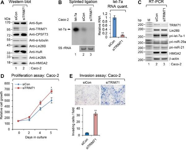 https://cdn.ncbi.nlm.nih.gov/pmc/blobs/cb0e/5346756/a7128c4a4605/oncotarget-07-79854-g003.jpg