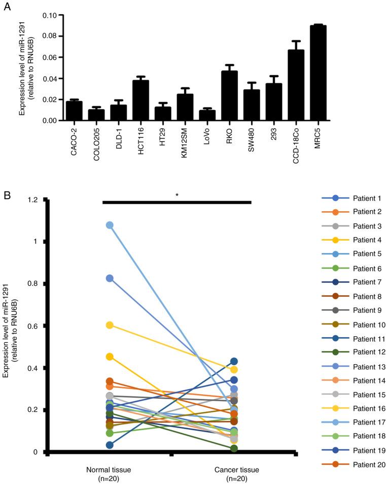 https://cdn.ncbi.nlm.nih.gov/pmc/blobs/cb70/8759348/d0e533493a83/IJO-60-02-05303-g00.jpg