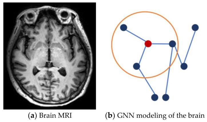 https://cdn.ncbi.nlm.nih.gov/pmc/blobs/cc8c/10605282/2067aba323b8/brainsci-13-01462-g001.jpg