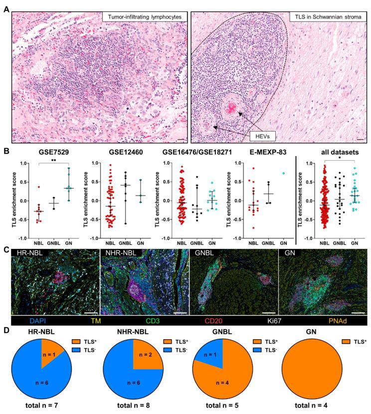 https://cdn.ncbi.nlm.nih.gov/pmc/blobs/cce3/12025499/ab2878f15193/cancers-17-01303-g004.jpg
