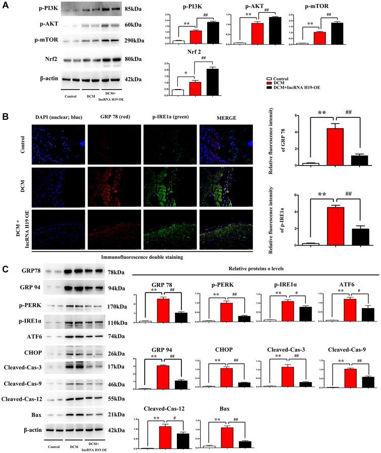 https://cdn.ncbi.nlm.nih.gov/pmc/blobs/cee1/9467416/2a82cfec6c58/aging-14-204256-g004.jpg