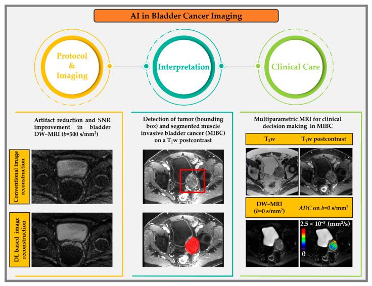 https://cdn.ncbi.nlm.nih.gov/pmc/blobs/d0b8/10670574/81cd5bfa6bbf/cancers-15-05468-g004.jpg