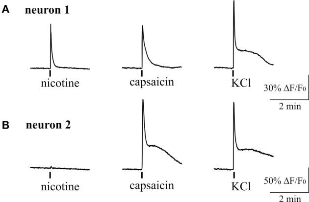 https://cdn.ncbi.nlm.nih.gov/pmc/blobs/d214/5406407/e79eadd1974f/fneur-08-00163-g006.jpg