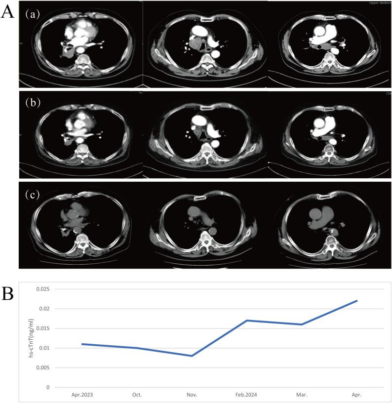 https://cdn.ncbi.nlm.nih.gov/pmc/blobs/d336/12328319/d9f3ae2957ca/fimmu-16-1627147-g003.jpg