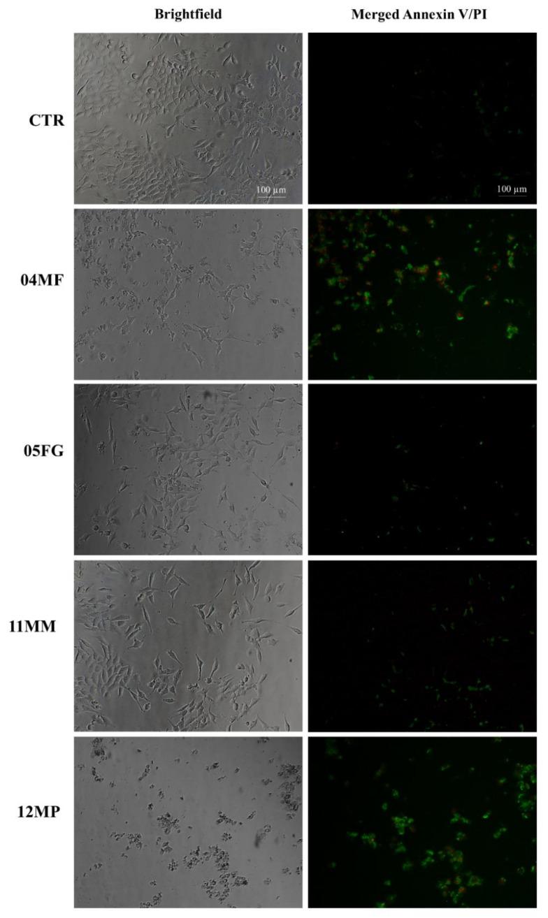 https://cdn.ncbi.nlm.nih.gov/pmc/blobs/d386/11858132/39f6ad90bed9/molecules-30-00821-g007.jpg