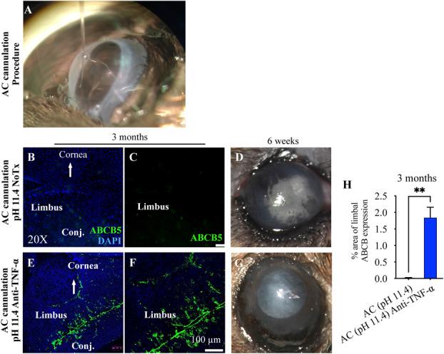 https://cdn.ncbi.nlm.nih.gov/pmc/blobs/d4cb/12052064/273803f300e2/cornea-44-762-g001.jpg