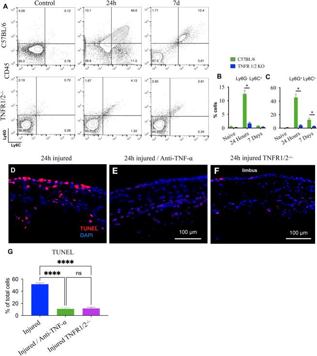 https://cdn.ncbi.nlm.nih.gov/pmc/blobs/d4cb/12052064/694eb3eafb71/cornea-44-762-g005.jpg