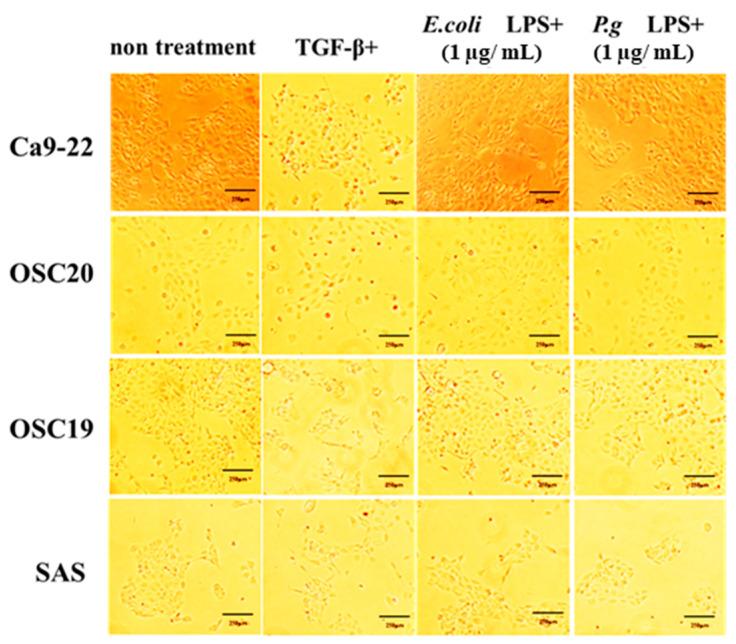 https://cdn.ncbi.nlm.nih.gov/pmc/blobs/d551/10813992/4a9d8b4a5c3c/cancers-16-00343-g007.jpg
