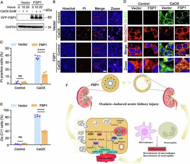 https://cdn.ncbi.nlm.nih.gov/pmc/blobs/d5ab/12174353/49e87147cb8d/41420_2025_2557_Fig7_HTML.jpg