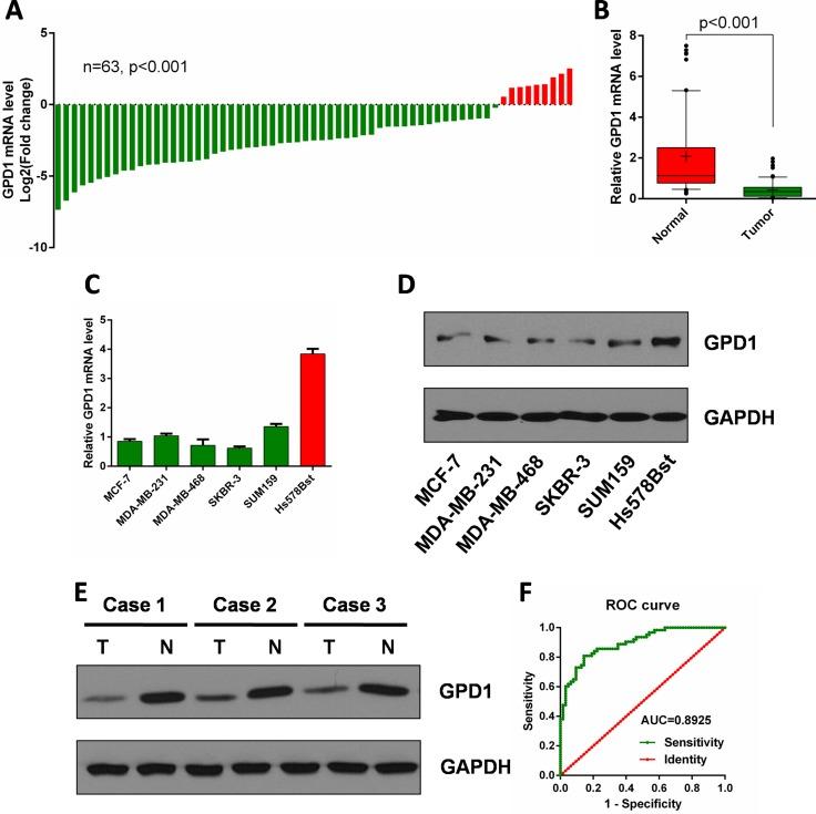 https://cdn.ncbi.nlm.nih.gov/pmc/blobs/d5d9/5731876/3dbada7cba12/oncotarget-08-101309-g004.jpg