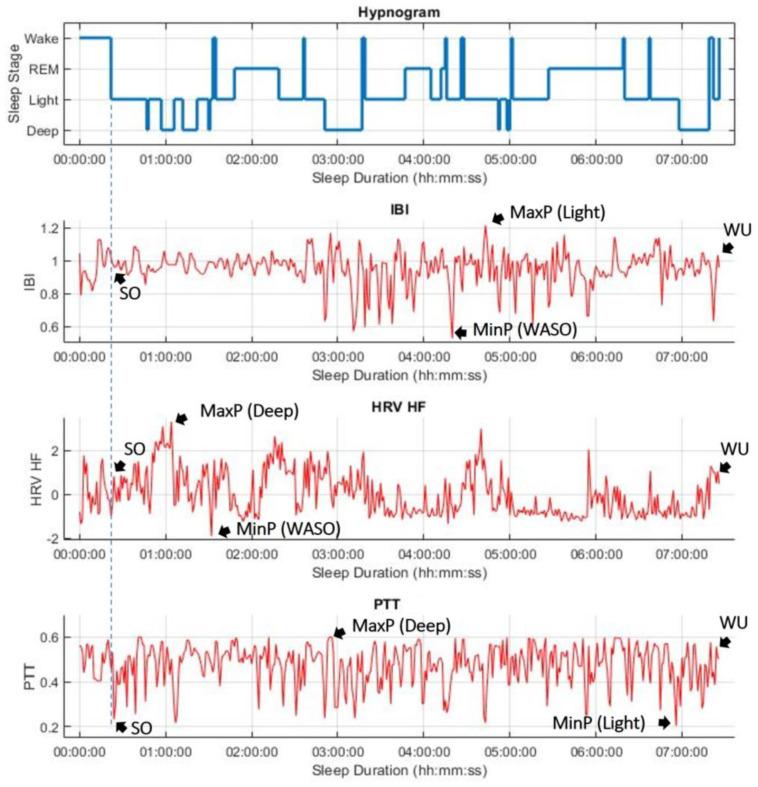 https://cdn.ncbi.nlm.nih.gov/pmc/blobs/d5dc/10255868/a79de1bca2ba/sensors-23-05112-g003.jpg