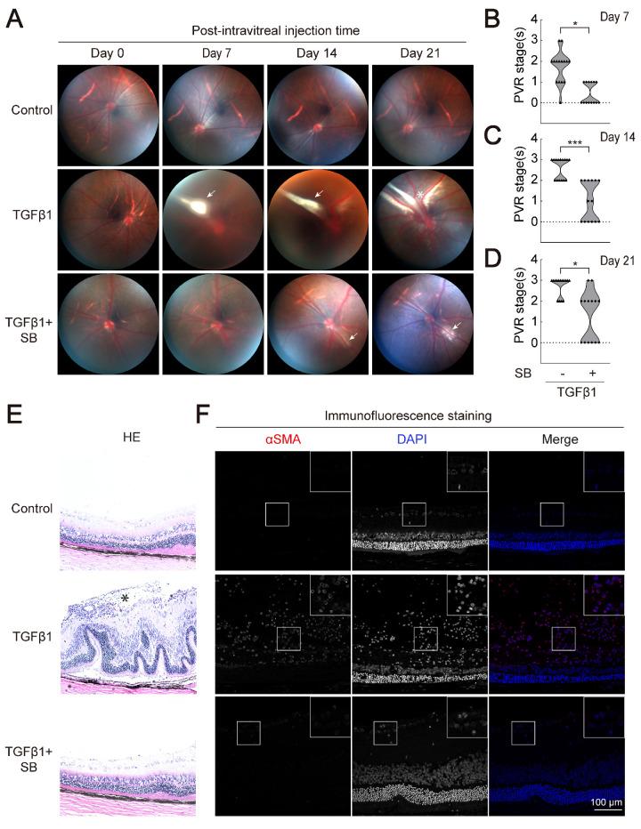 https://cdn.ncbi.nlm.nih.gov/pmc/blobs/da5b/10619698/edc0570029bf/iovs-64-13-47-f004.jpg