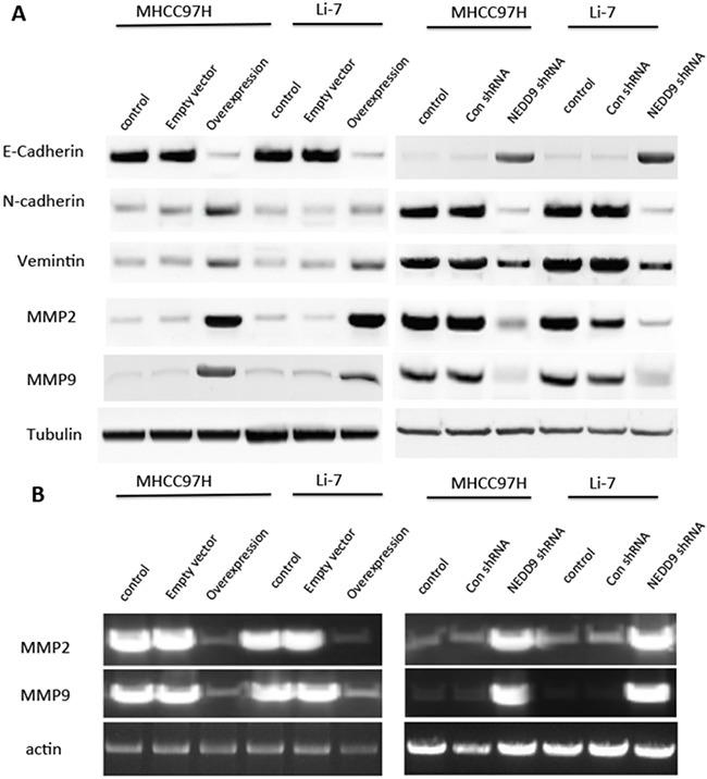https://cdn.ncbi.nlm.nih.gov/pmc/blobs/dbb8/5352091/0fc246253dc1/oncotarget-08-1714-g003.jpg