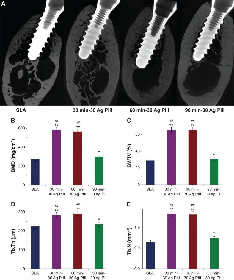 https://cdn.ncbi.nlm.nih.gov/pmc/blobs/dc75/4298332/77be19a275fa/ijn-10-653Fig5.jpg