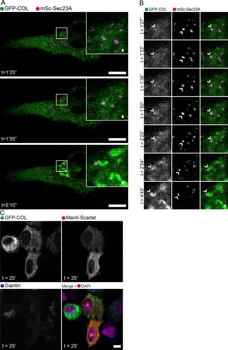 https://cdn.ncbi.nlm.nih.gov/pmc/blobs/dce5/6400576/3ec7776a31e1/JCB_201806035_Fig4.jpg