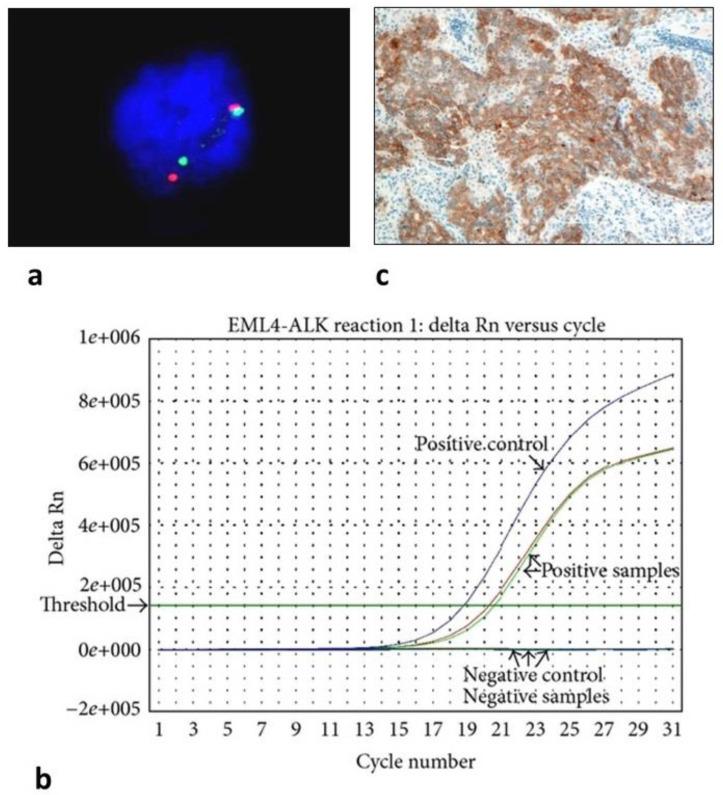 https://cdn.ncbi.nlm.nih.gov/pmc/blobs/e4cf/9331210/1b08b256622c/biomolecules-12-01021-g001.jpg