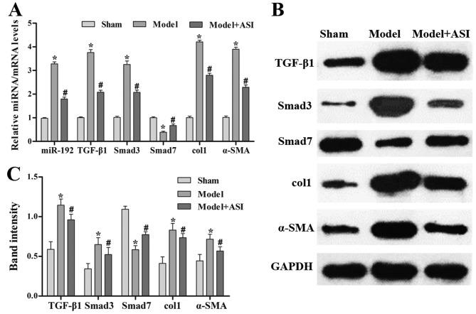 https://cdn.ncbi.nlm.nih.gov/pmc/blobs/e75a/6755437/3f4687651b64/etm-18-04-3053-g03.jpg