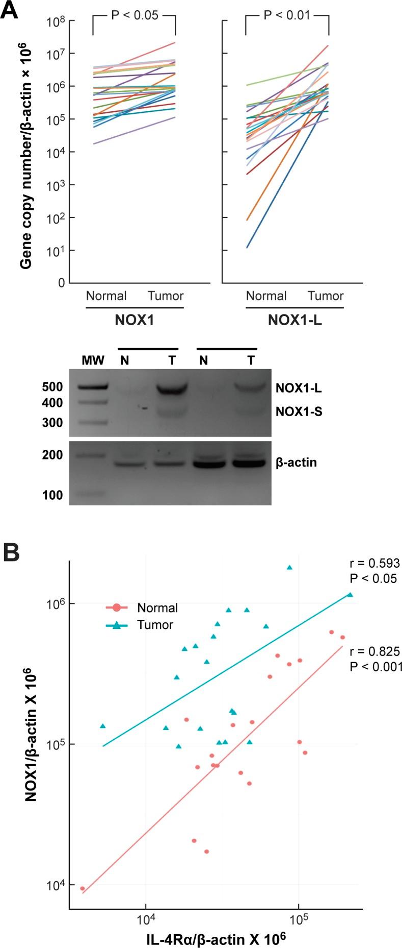 https://cdn.ncbi.nlm.nih.gov/pmc/blobs/e92b/5503519/623099269188/oncotarget-08-38113-g008.jpg