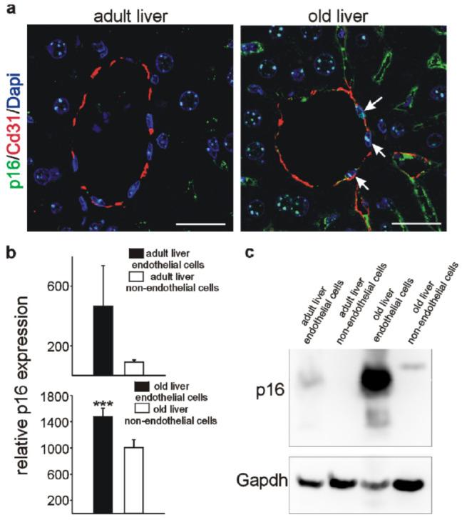 https://cdn.ncbi.nlm.nih.gov/pmc/blobs/eb61/8833900/c85e6e629bd2/cells-11-00541-g008.jpg