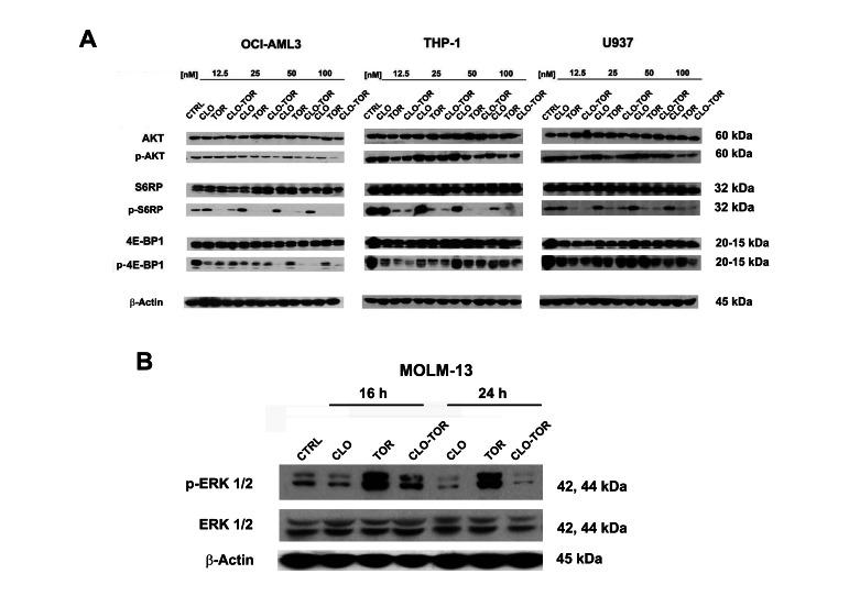 https://cdn.ncbi.nlm.nih.gov/pmc/blobs/f0d1/3681499/328099b9f629/oncotarget-03-1615-g004.jpg