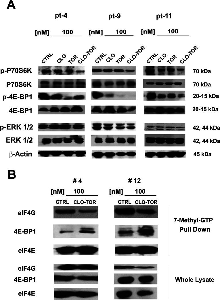 https://cdn.ncbi.nlm.nih.gov/pmc/blobs/f0d1/3681499/c7e924dae3f2/oncotarget-03-1615-g006.jpg