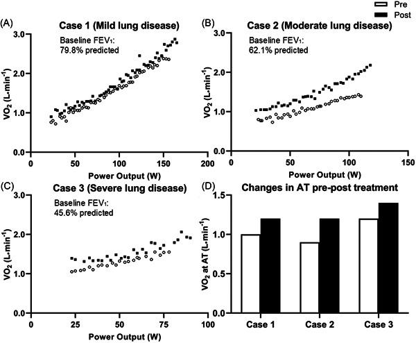 https://cdn.ncbi.nlm.nih.gov/pmc/blobs/f297/9795914/97ae74f1bf4c/PPUL-57-2652-g001.jpg