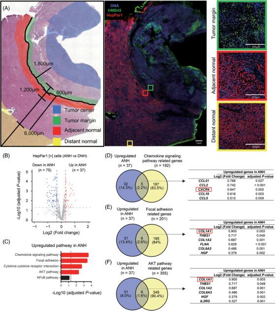 https://cdn.ncbi.nlm.nih.gov/pmc/blobs/f3a5/11534464/636ec9fe22c3/CTM2-14-e70067-g007.jpg